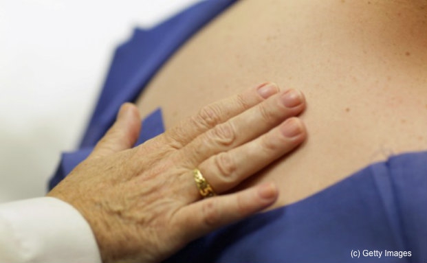 Hautkrebs wird ein Fall für die Unfallversicherung