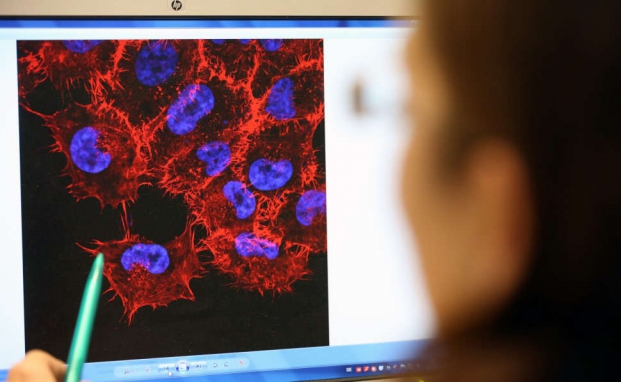 Bei Finanzierungen oder Geschäftsführern gehört Dread-Disease-Schutz dazu