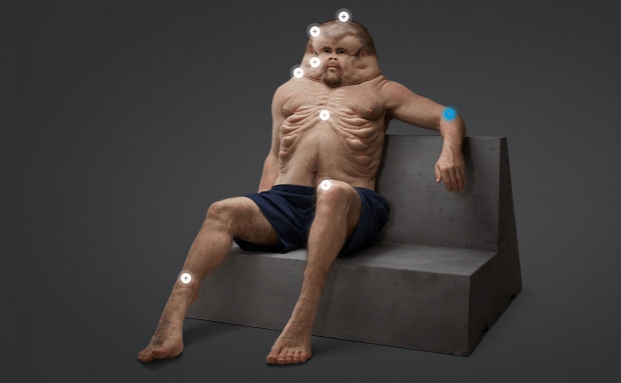 Der Mann, der Autounfälle überlebt