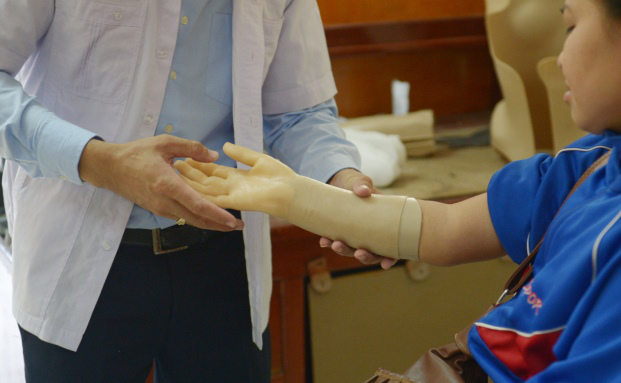 Frau lässt sich Hand und Fuß amputieren