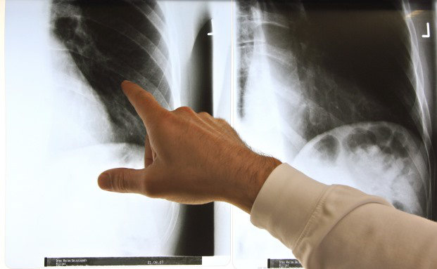 Das sind die besten privaten Krankenversicherer