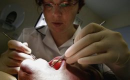 GKV-Versicherte wollen Zuschüsse für professionelle Zahnreinigung