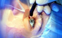 Privater Krankenversicherer muss Lasik-Operation für Fehlsichtige zahlen