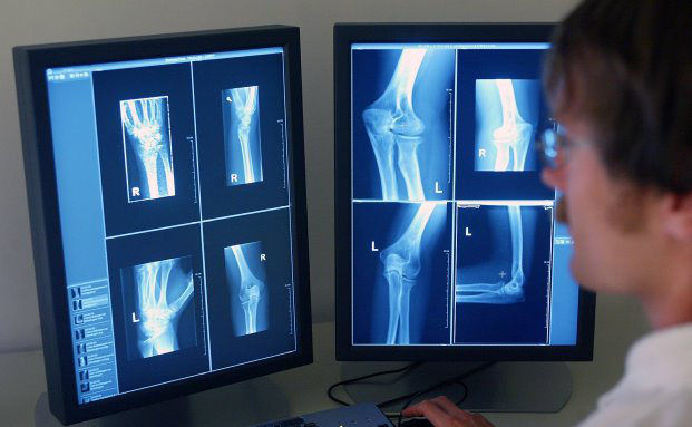 „Paritätische Beitragsfinanzierung in der GKV käme die Gesellschaft teuer zu stehen“