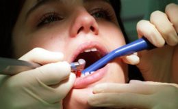 Zuschüsse zur professionellen Zahnreinigung unterscheiden sich