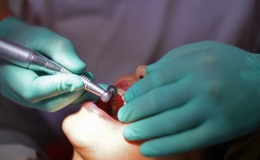 Diese Zahnarztkosten können von der Steuer abgesetzt werden