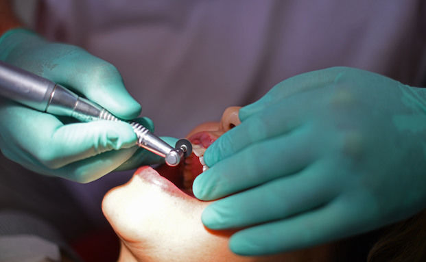 Diese Zahnarztkosten können von der Steuer abgesetzt werden