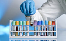 Wie entstehen Normwerte?