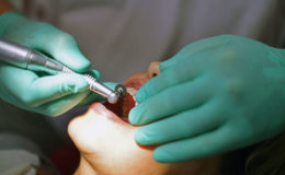 Die besten Zahnzusatzversicherungen im Makler-Fokus