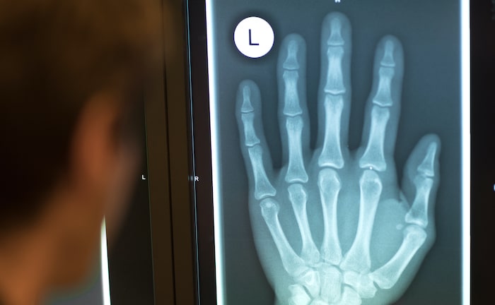 Gesetzlich Versicherte verschenken 4,5 Milliarden Euro