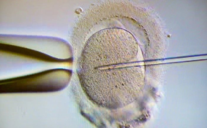 Ist der Ehemann über 50, gibt es keine Beihilfe