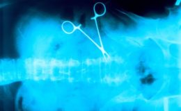 Wie man bei Behandlungsfehlern vorgehen sollte