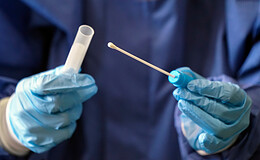 PKV-Verband wehrt sich gegen Rede von Zwang