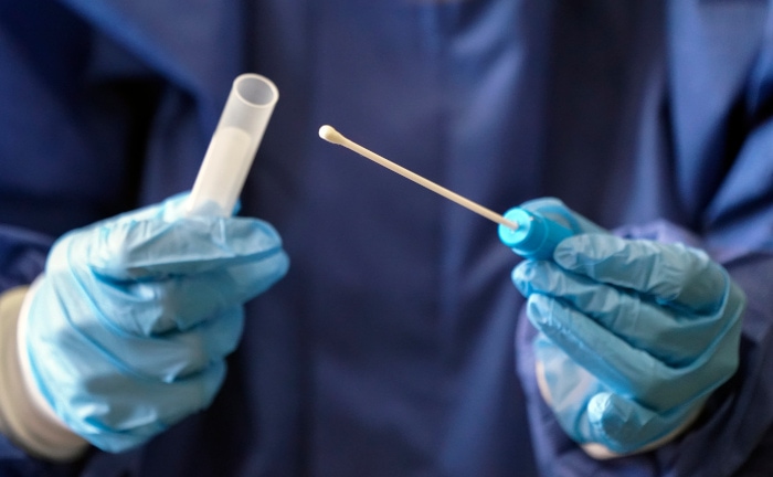 PKV-Verband wehrt sich gegen Rede von Zwang