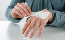 Wie Narben optimal behandelt werden