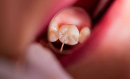 Welche Krankenzusatzversicherungen vermitteln Vema-Makler?