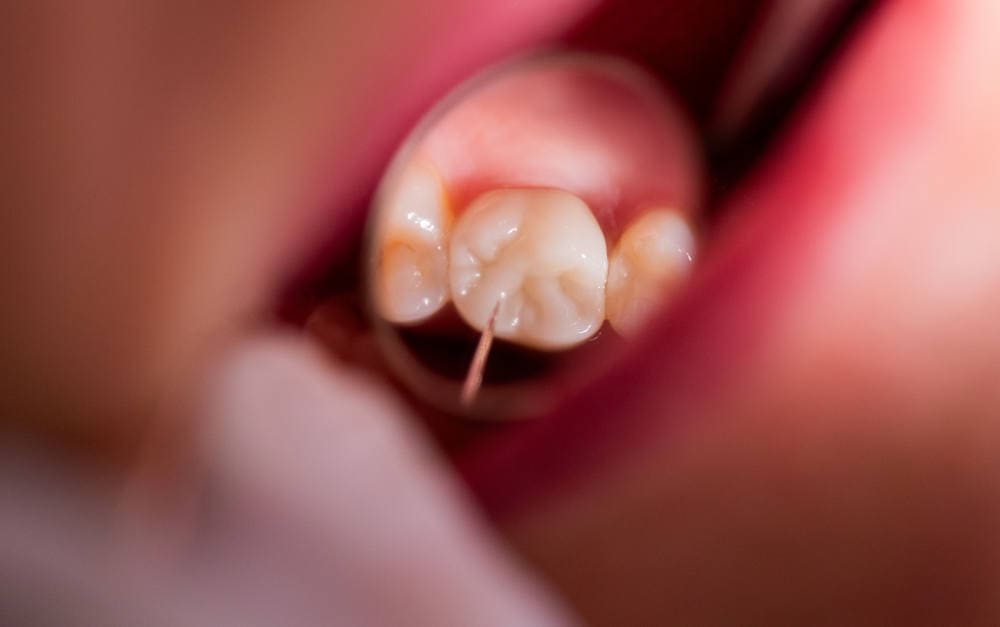 Welche Krankenzusatzversicherungen vermitteln Vema-Makler?