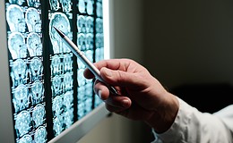 Selbstständige häufiger wegen schwerer Krankheiten besorgt