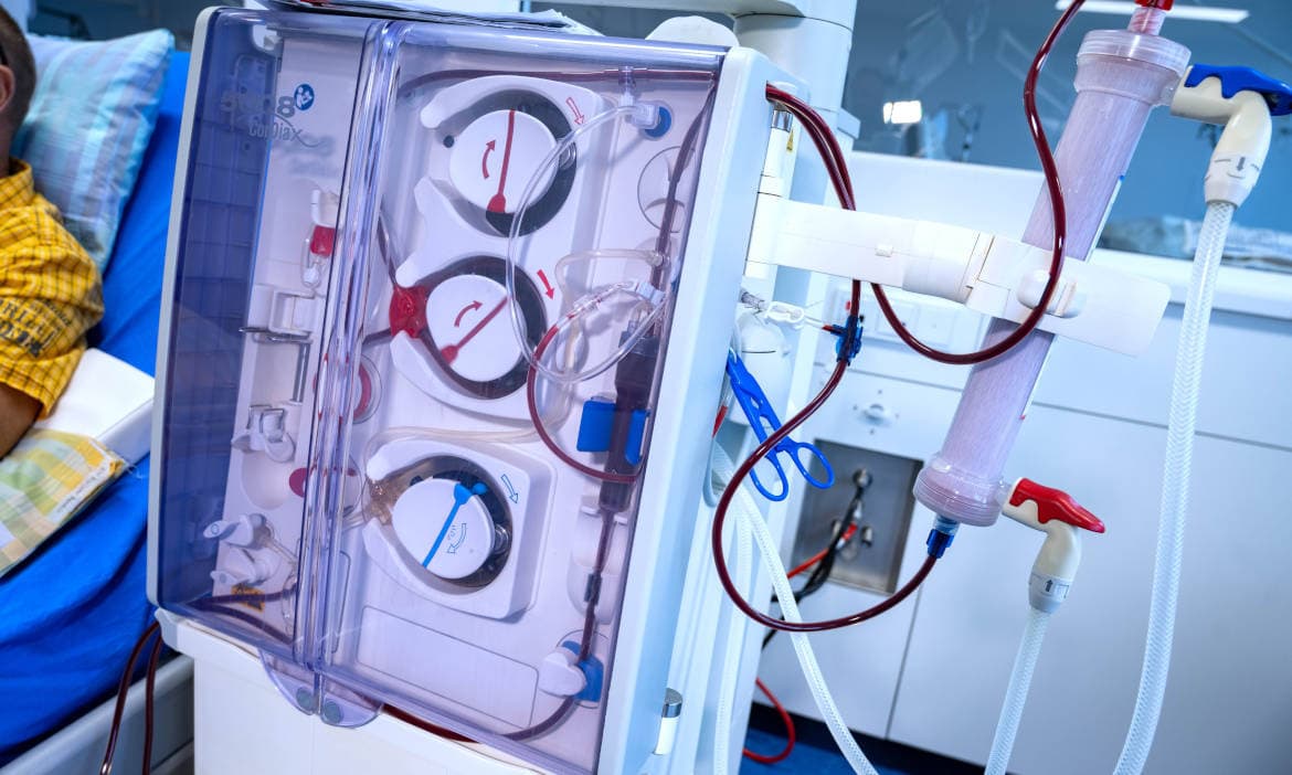 Dialysegerät im Krankenhaus für Nierenbehandlung.